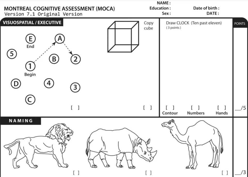 cognitive test